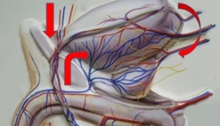 варикозное расширение вен органов малого таза
