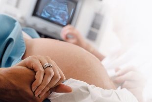  варикозное расширение вен во время беременности